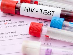 75 Pramuria dan Waria Ditest HIV/ AIDS